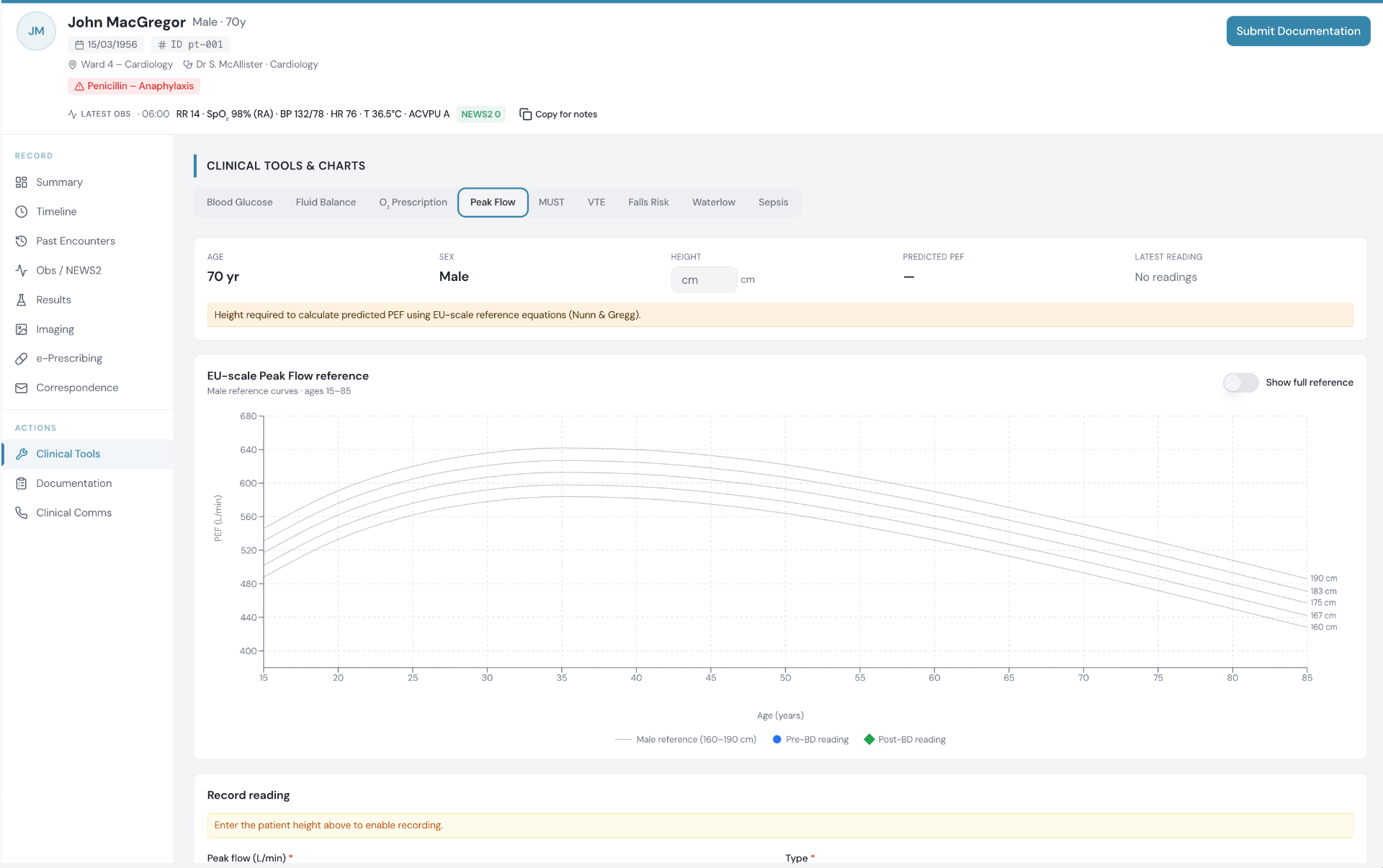 Patient Records clinical tools showing the EU-scale Peak Flow reference chart with male reference curves.