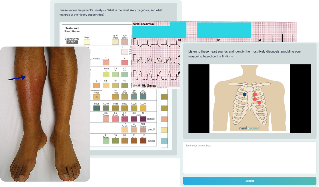 Post-encounter tasks: clinical photograph of lower limbs, urinalysis dipstick, ECG strip and heart-sound auscultation interpretation.